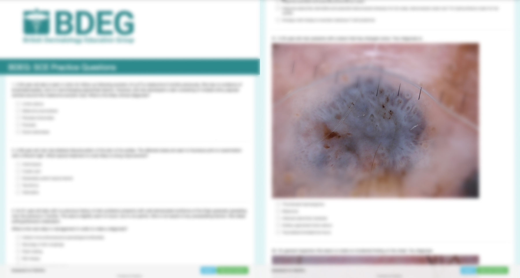 Practice Test MCQ for Dermatology SCE feature image